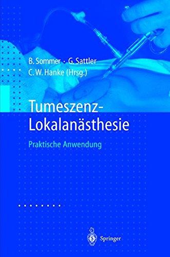 Tumeszenz-Lokalanästhesie. Praktische Anwendung