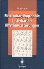 Elektrokardiographie tachykarder Rhythmusstörungen