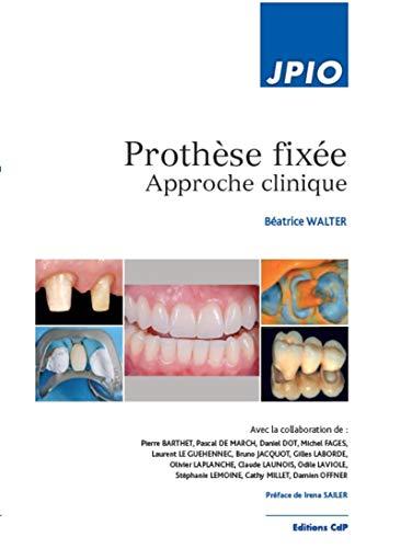 Prothèse fixée : approche clinique