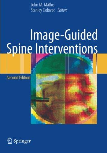 Image-Guided Spine Interventions