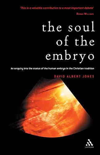 The Soul of the Embryo: An Enquiry into the Status of the Human Embryo in the Christian Tradition: Christianity and the Human Embryo