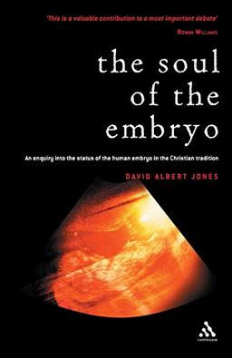 The Soul of the Embryo: An Enquiry into the Status of the Human Embryo in the Christian Tradition: Christianity and the Human Embryo