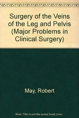 Surgery of the Veins of the Leg and Pelvis (Major Problems in Clinical Surgery S.)