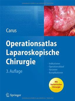 Operationsatlas Laparoskopische Chirurgie: Indikationen - Operationsablauf - Varianten - Komplikationen