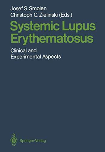 Systemic Lupus Erythematosus: Clinical and Experimental Aspects