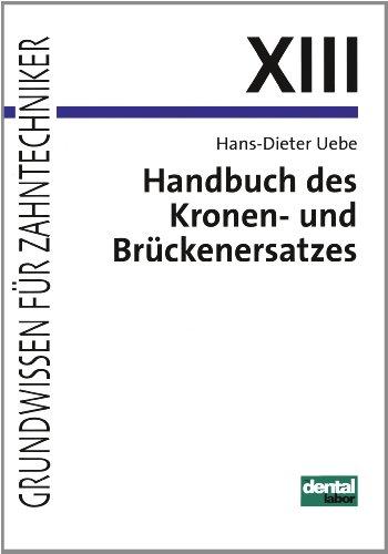 Grundwissen für Zahntechniker, Tl.13, Handbuch des Kronenersatzes und Brückenersatzes