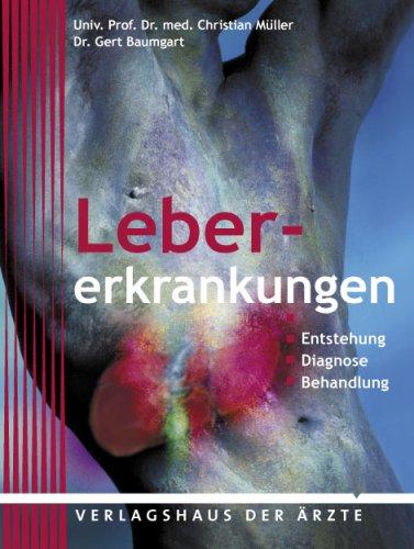 Beleidigte Leber: Hepatitis, Zirrhose, Leberkarzinom & Co. Eine Orientierungshilfe für Patienten und Laien