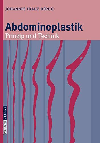 Abdominoplastik: Prinzip und Technik