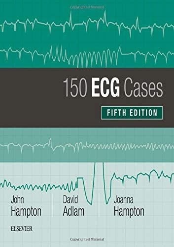 150 ECG Cases