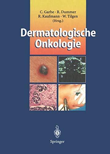 Dermatologische Onkologie