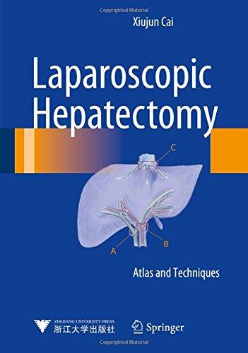 Laparoscopic Hepatectomy: Atlas and Techniques