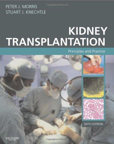 Kidney Transplantation: Principles and Practice