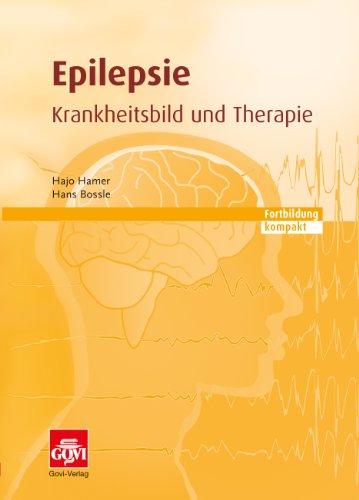 Epilepsie: Fortbildung kompakt