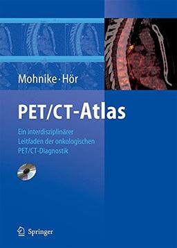 PET/CT-Atlas: Ein interdisziplinärer Leitfaden der onkologischen PET/CT-Diagnostik: Ein Interdisziplinarer Leitfaden Der Onkologischen Pet/Ct-Diagnostik