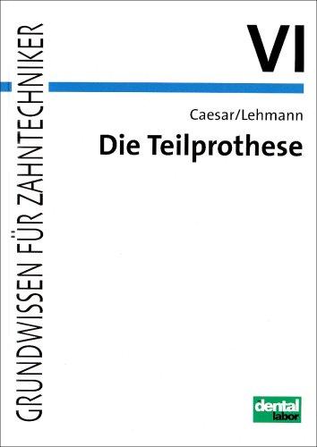 Grundwissen für Zahntechniker / Die Teilprothese