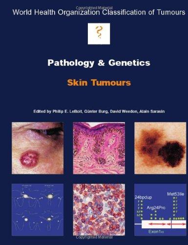 Pathology and Genetics of Skin Tumours (World Organization Classification of Tumors, Band 10)