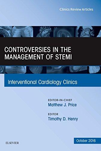 Controversies in the Management of STEMI, An Issue of the Interventional Cardiology Clinics (Volume 5-4) (The Clinics: Internal Medicine, Volume 5-4)