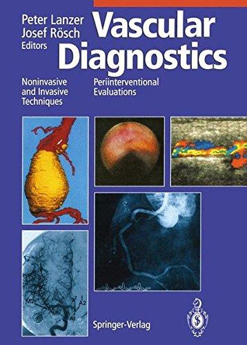 Vascular Diagnostics: Noninvasive and Invasive Techniques Periinterventional Evaluations: Noninvasive and Invasive Techniques - Periinterventional Evaluations, with Contributions by Numerous Experts