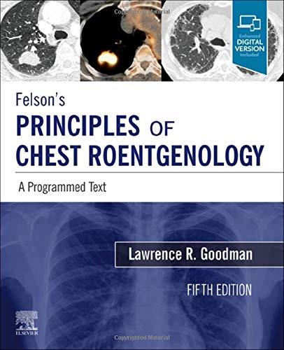 Felson's Principles of Chest Roentgenology, A Programmed Text: A Programmed Text