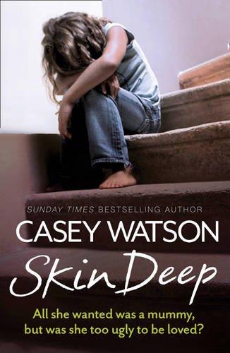 Skin Deep: All She Wanted Was a Mummy, but Was She Too Ugly to be Loved?