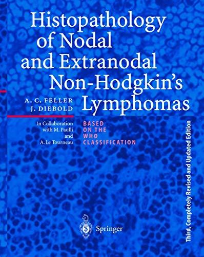 Histopathology of Nodal and Extranodal Non-Hodgkin’s Lymphomas