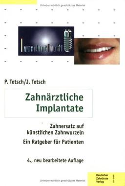 Zahnärztliche Implantate