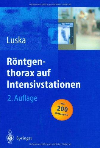 Röntgenthorax auf Intensivstationen