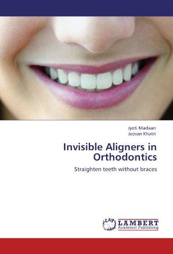 Invisible Aligners in Orthodontics: Straighten teeth without braces