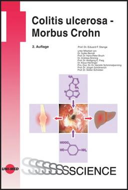 Colitis ulcerosa - Morbus Crohn