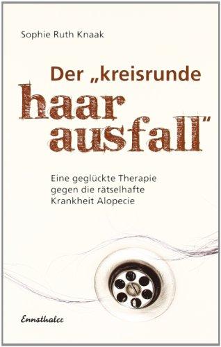 Der "kreisrunde Haarausfall": Eine geglückte Therapie gegen die rätselhafte Krankheit Alopecie