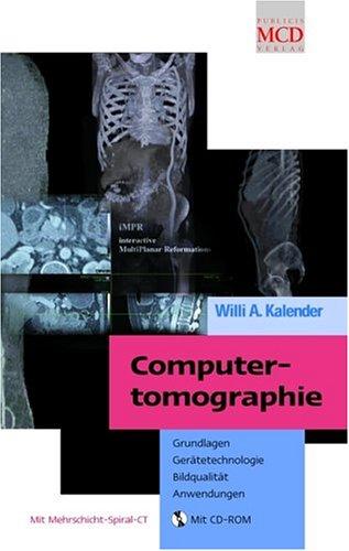 Computertomographie: Grundlagen, Gerätetechnologie, Bildqualität, Anwendungen: Grundlagen, Geratetechnolgie Bildqualitat, Anwendungen