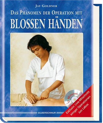 Das Phänomen der Operation mit blossen Händen, m. DVD