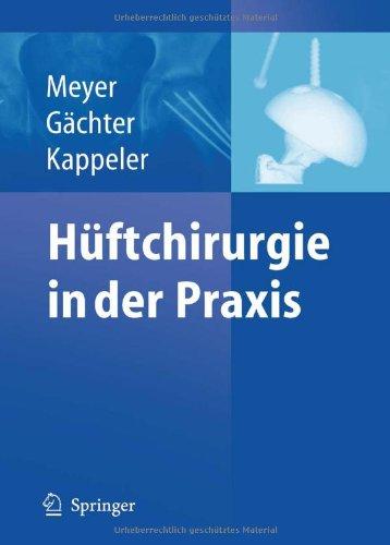 Hüftchirurgie in der Praxis