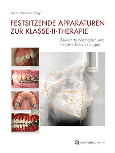 Festsitzende Apparaturen zur Klasse-II-Therapie: Bewährte Methoden und neueste Entwicklungen