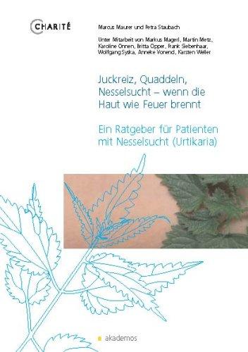 Juckreiz, Quaddeln, Nesselsucht - wenn die Haut wie Feuer brennt: Ein Ratgeber für Patienten mit Nesselsucht (Urtikaria)