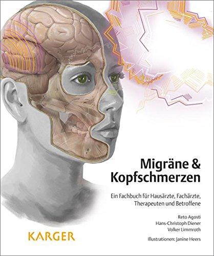 Migräne und Kopfschmerzen: Ein Fachbuch für Hausärzte, Fachärzte, Therapeuten und Betroffene Illustrationen: J. Heers.