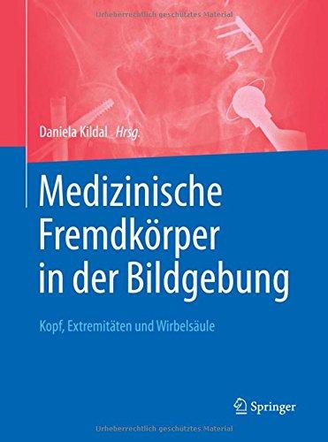 Medizinische Fremdkörper in der Bildgebung: Kopf, Extremitäten und Wirbelsäule