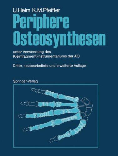 Periphere Osteosynthesen: unter Verwendung des Kleinfragment-Instrumentariums der AO