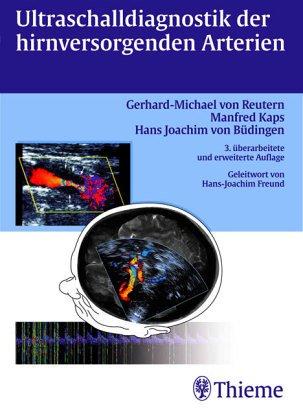 Ultraschalldiagnostik der hirnversorgenden Arterien
