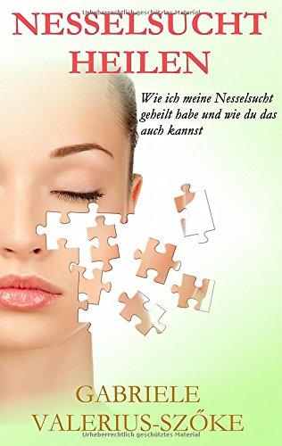 Nesselsucht heilen: Wie ich meine Nesselsucht geheilt habe und wie du das auch kannst