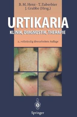 Urtikaria: Klinik, Diagnostik, Therapie