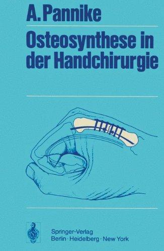 Osteosynthese in der Handchirurgie