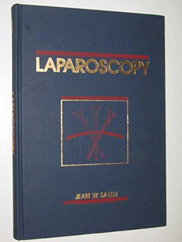 Laparoscopy