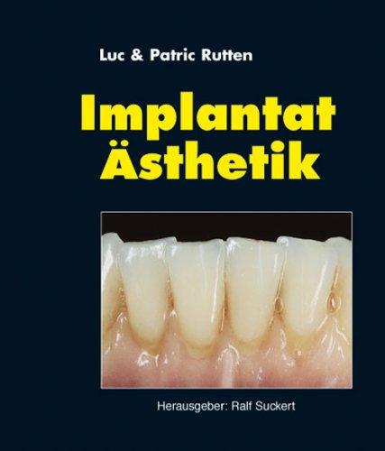 Implantat-Ästhetik