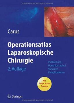 Operationsatlas Laparoskopische Chirurgie: Indikationen - Operationsablauf - Varianten - Komplikationen Mit Single Access Surgery