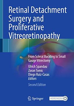 Retinal Detachment Surgery and Proliferative Vitreoretinopathy: From Scleral Buckling to Small Gauge Vitrectomy