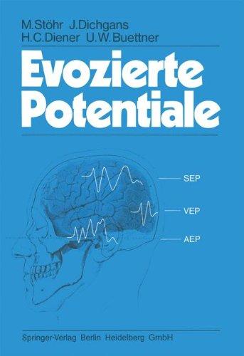 Evozierte Potentiale: SEP - VEP - AEP