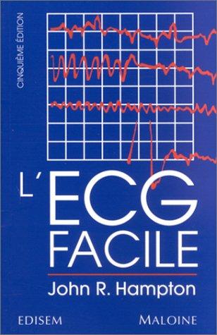 L'ECG facile