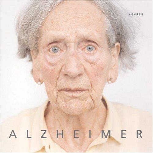 Alzheimer