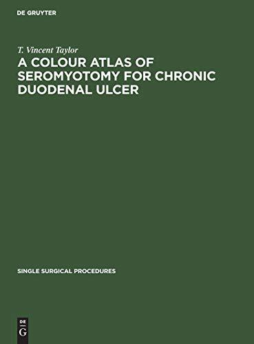 A Colour Atlas of Seromyotomy for Chronic Duodenal Ulcer (Single surgical procedures, 10, Band 10)